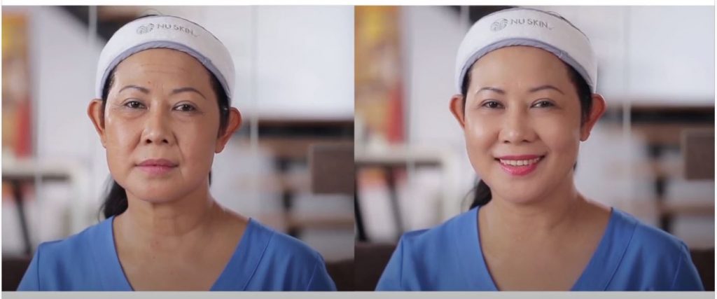 trước và sau khi sử dụng galvanic face spa