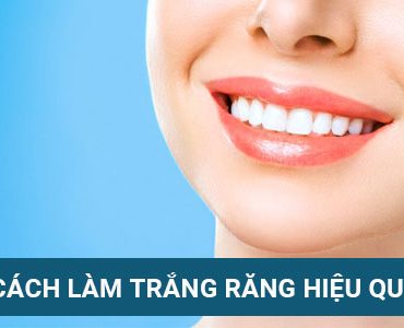 cach-lam-trang-rang-bang-kem-danh-rang-myphamnuskin